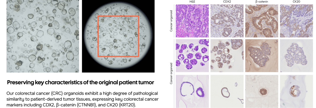 CRC Organoid Validation